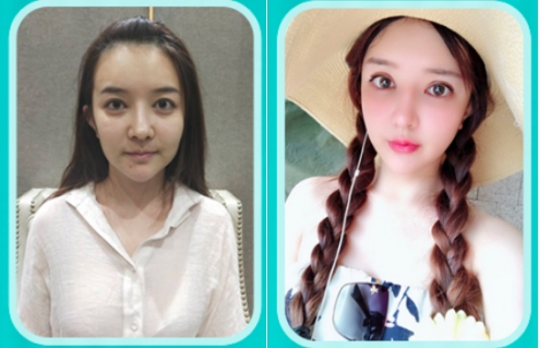 20多歲的姑娘既然衰老成(chéng)30+_廣州軍美醫療美容醫院